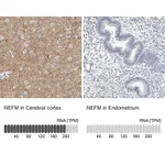 Atlas Antibodies Anti-NEFM Antibody