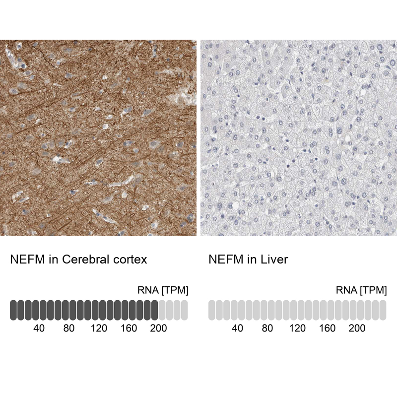 Atlas Antibodies Anti-NEFM Antibody