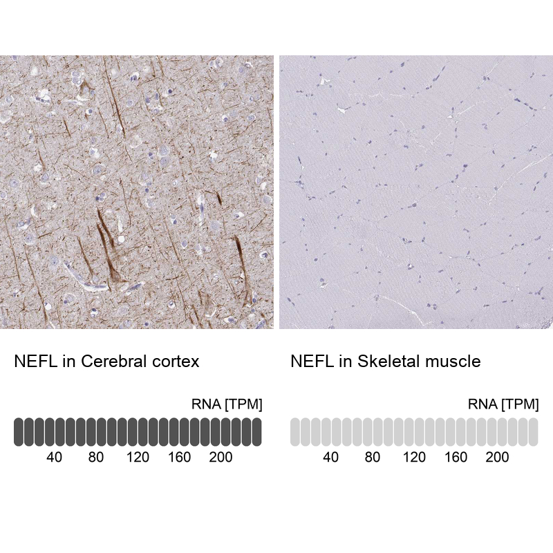 Atlas Antibodies Anti-NEFL Antibody