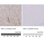 Atlas Antibodies Anti-NEFL Antibody