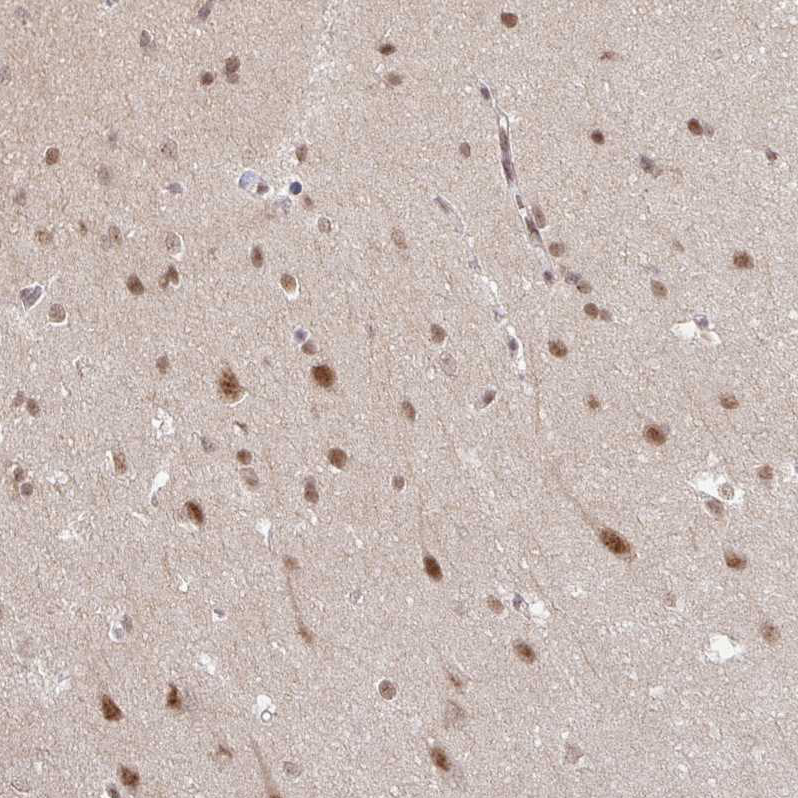 Atlas Antibodies Anti-NEIL1 Antibody