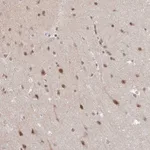Atlas Antibodies Anti-NEIL1 Antibody