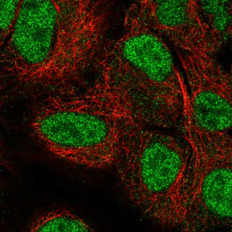 Atlas Antibodies Anti-NEIL2 Antibody