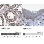 Atlas Antibodies Anti-NEK1 Antibody
