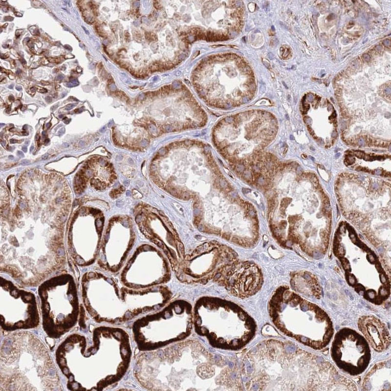 Atlas Antibodies Anti-NEK3 Antibody