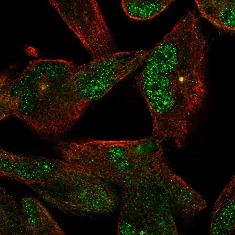 Atlas Antibodies Anti-NEK2 Antibody