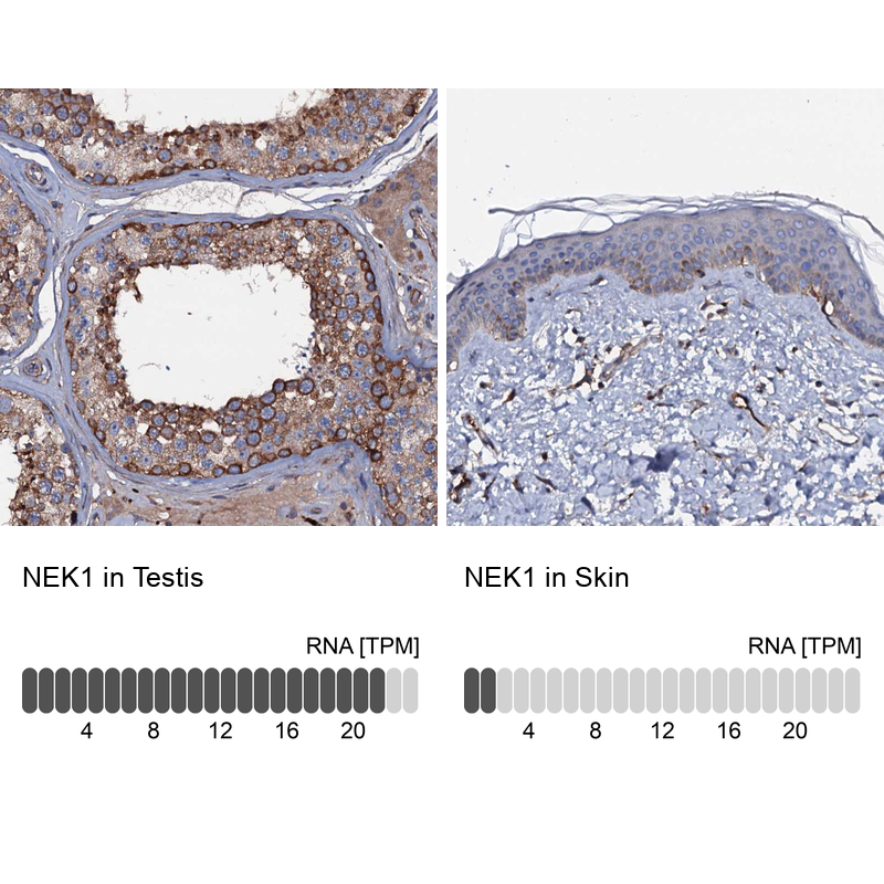 Atlas Antibodies Anti-NEK1 Antibody
