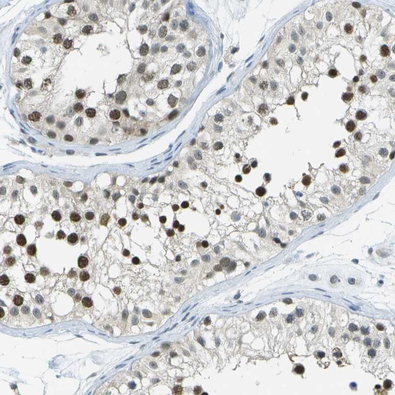 Atlas Antibodies Anti-NEK11 Antibody