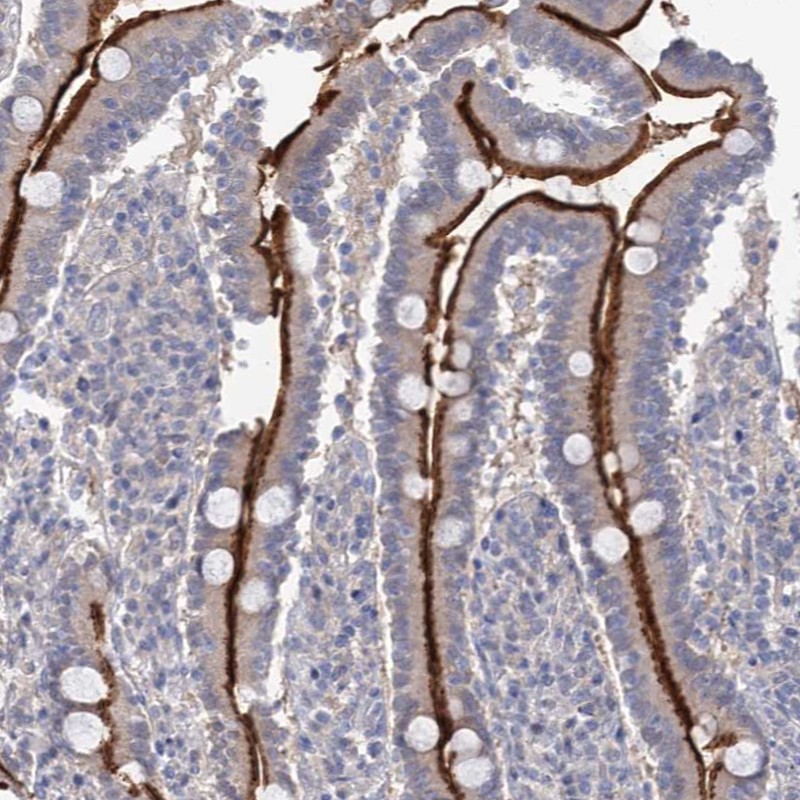 Atlas Antibodies Anti-NEK10 Antibody