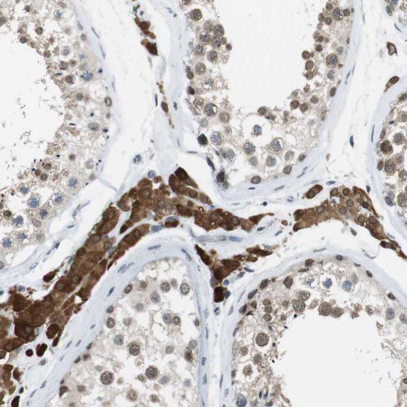 Atlas Antibodies Anti-NEK4 Antibody