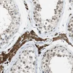 Atlas Antibodies Anti-NEK4 Antibody