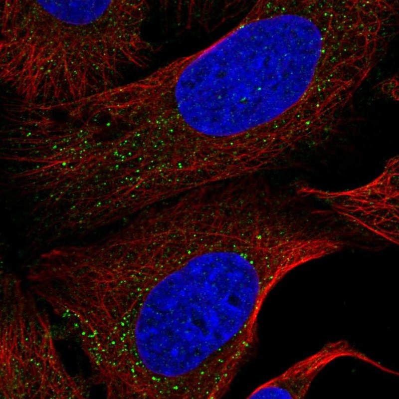 Atlas Antibodies Anti-NEK4 Antibody