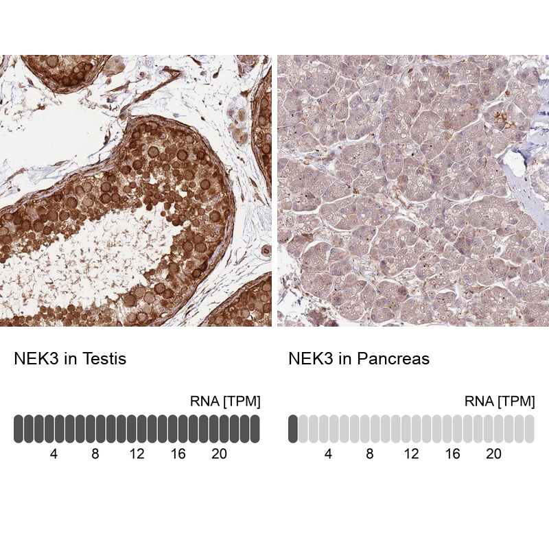 Atlas Antibodies Anti-NEK3 Antibody
