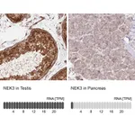 Atlas Antibodies Anti-NEK3 Antibody