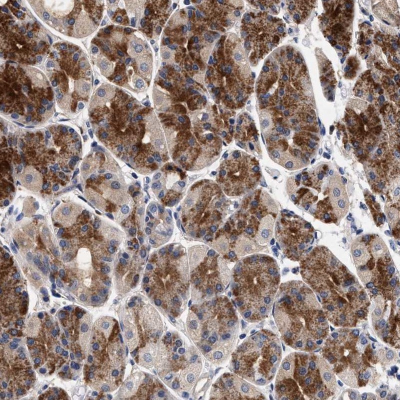 Atlas Antibodies Anti-NEK7 Antibody