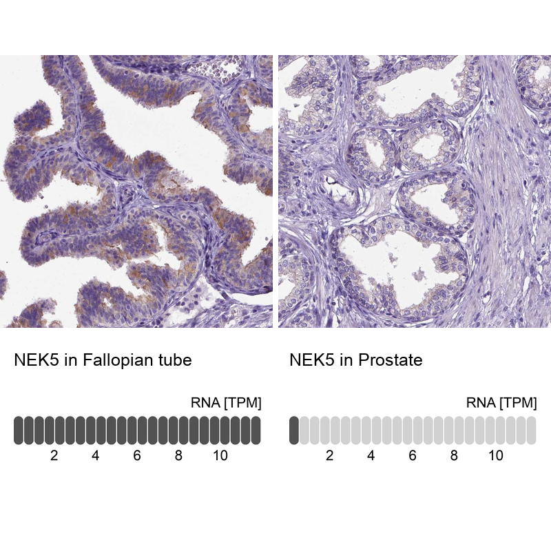 Atlas Antibodies Anti-NEK5 Antibody