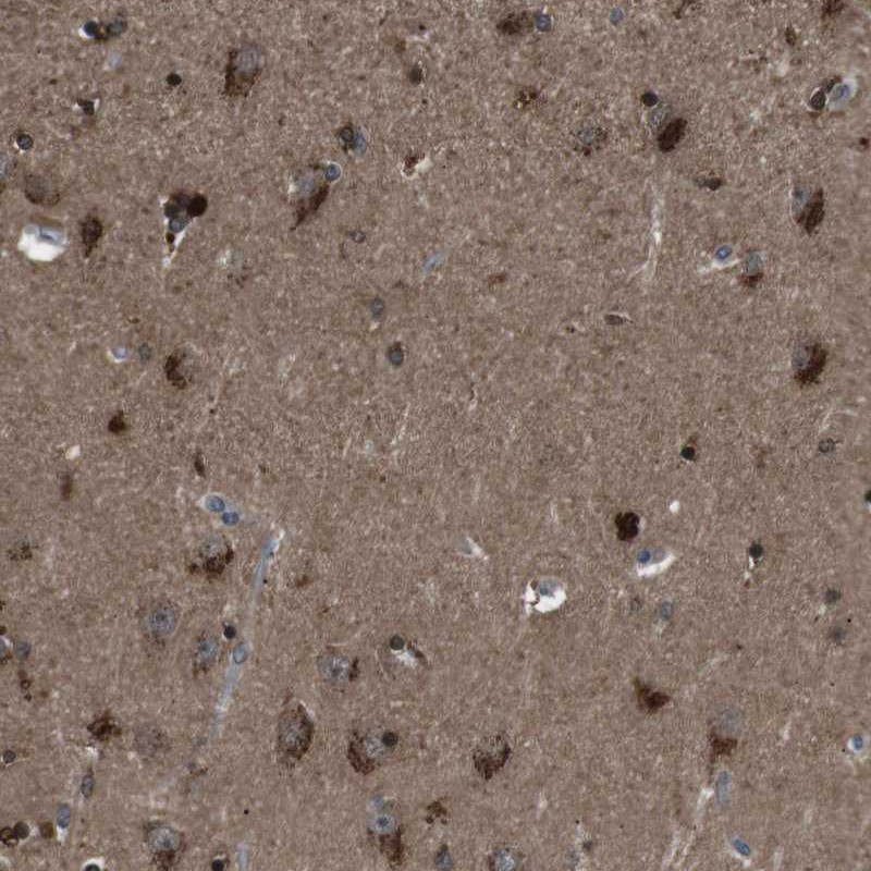 Atlas Antibodies Anti-NEK7 Antibody