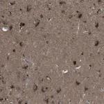 Atlas Antibodies Anti-NEK7 Antibody