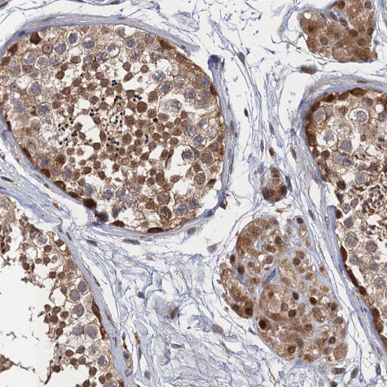 Atlas Antibodies Anti-NEK8 Antibody