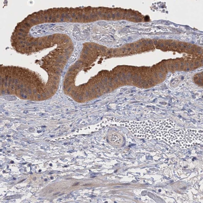 Atlas Antibodies Anti-NEK8 Antibody