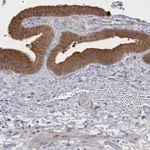 Atlas Antibodies Anti-NEK8 Antibody