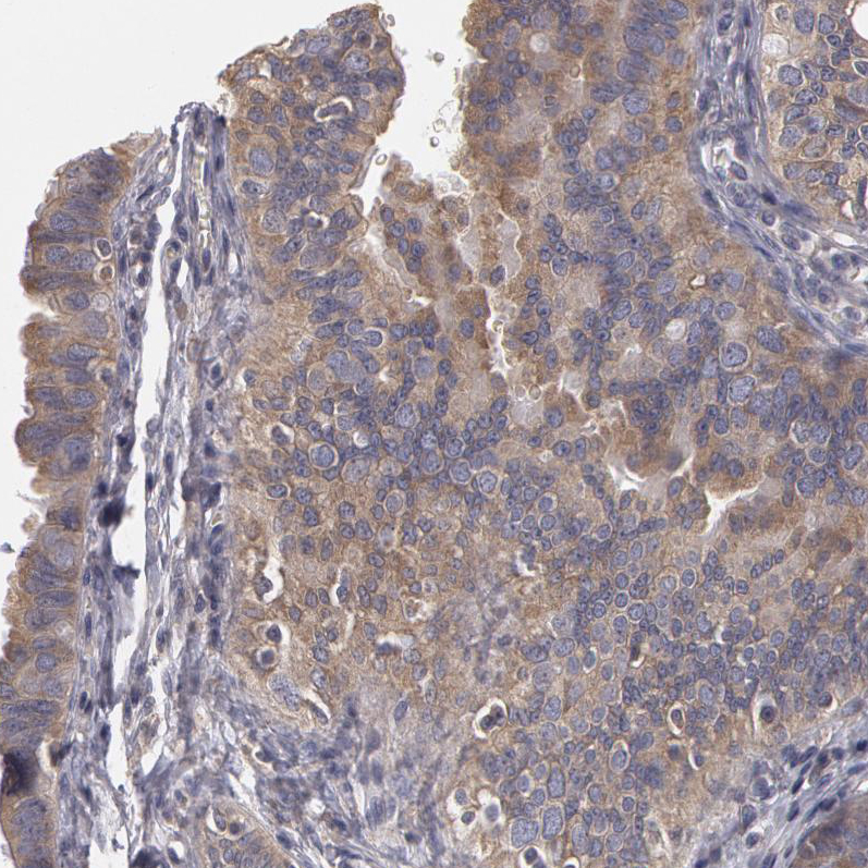 Atlas Antibodies Anti-NEK9 Antibody