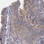 Atlas Antibodies Anti-NEK9 Antibody