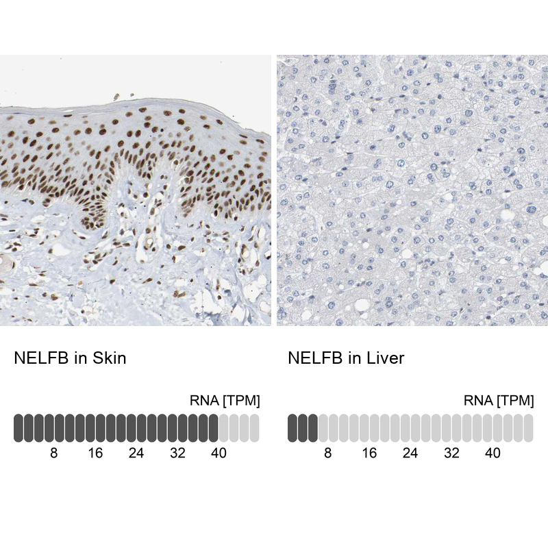 Atlas Antibodies Anti-NELFB Antibody
