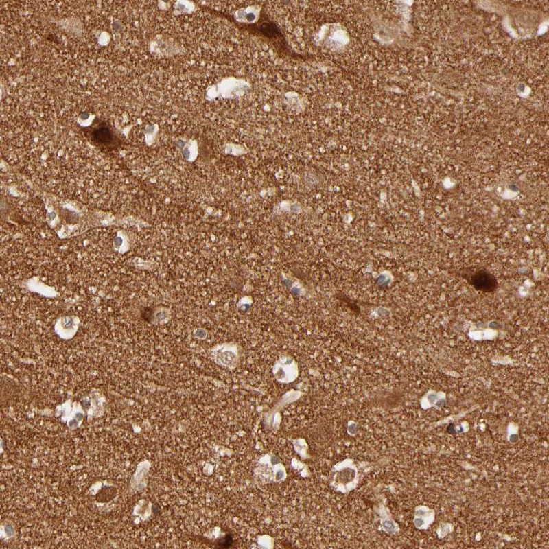 Atlas Antibodies Anti-NEMF Antibody