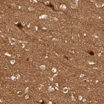 Atlas Antibodies Anti-NEMF Antibody