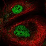 Atlas Antibodies Anti-NEMP2 Antibody