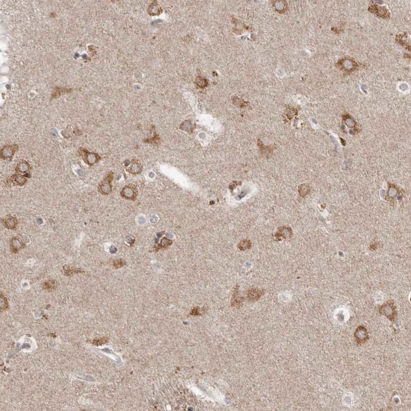 Atlas Antibodies Anti-NENF Antibody