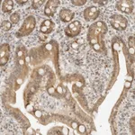 Atlas Antibodies Anti-NEO1 Antibody