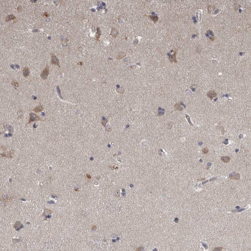 Atlas Antibodies Anti-NENF Antibody
