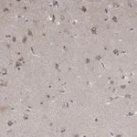 Atlas Antibodies Anti-NENF Antibody