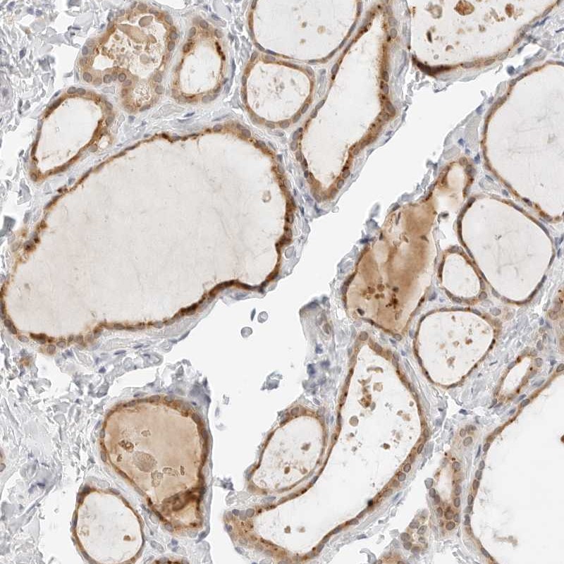 Atlas Antibodies Anti-NEO1 Antibody