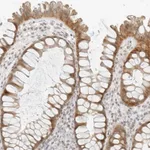 Atlas Antibodies Anti-NEO1 Antibody