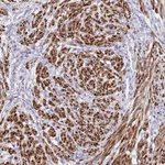 Atlas Antibodies Anti-NET1 Antibody