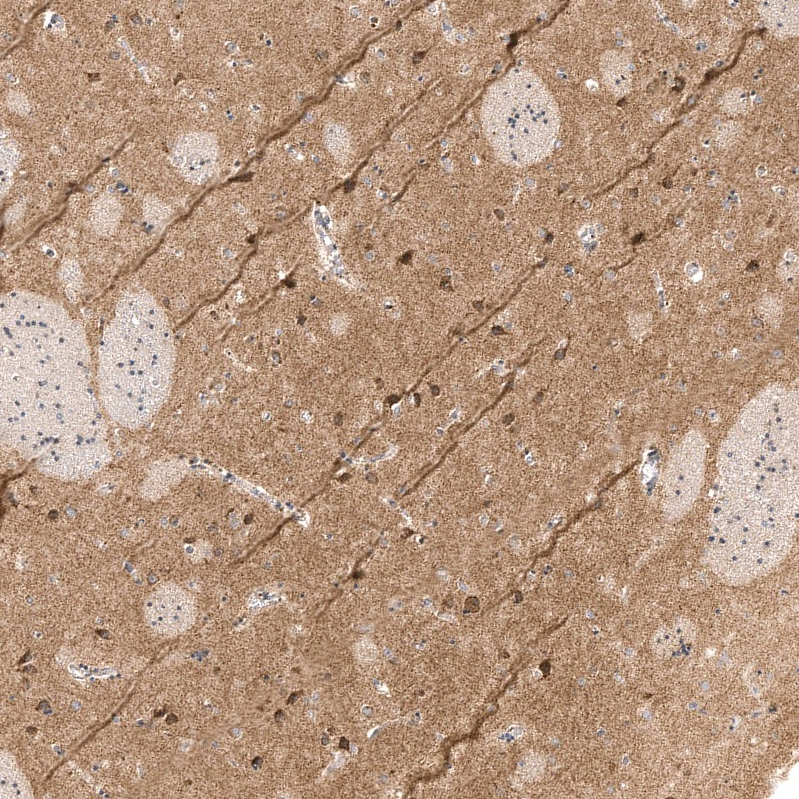 Atlas Antibodies Anti-NETO2 Antibody