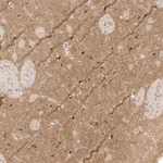 Atlas Antibodies Anti-NETO2 Antibody