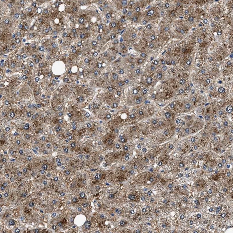Atlas Antibodies Anti-NEU1 Antibody