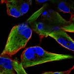 Atlas Antibodies Anti-NES Antibody