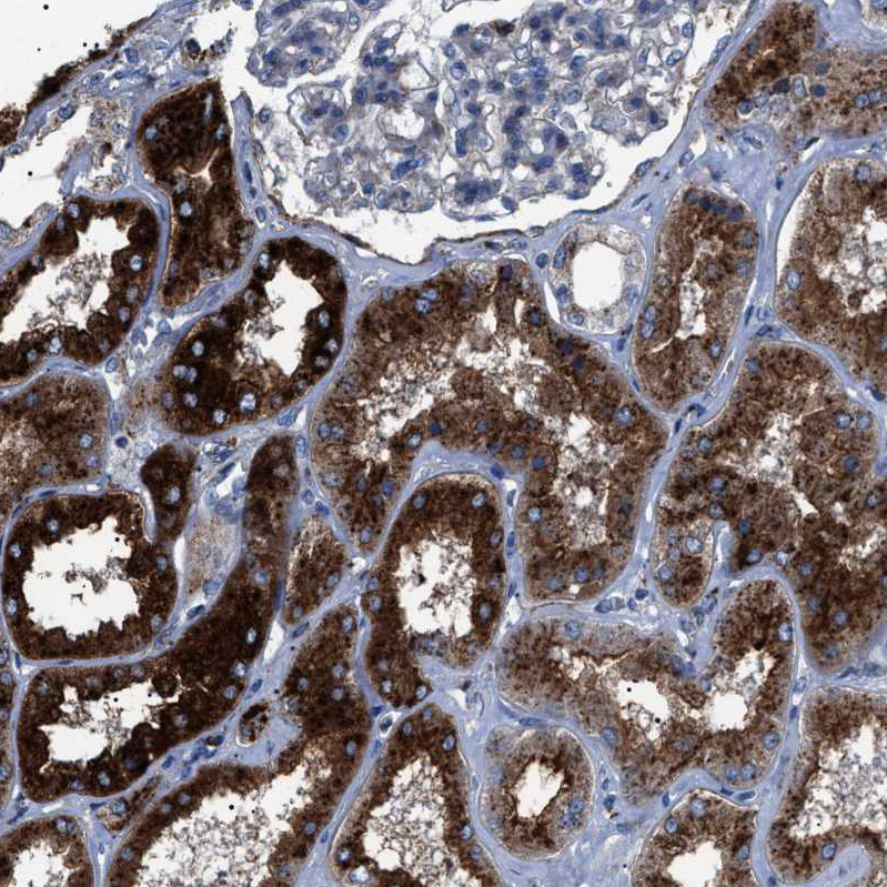 Atlas Antibodies Anti-NEU1 Antibody