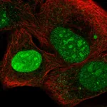 Atlas Antibodies Anti-NEPRO Antibody