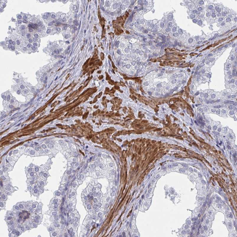 Atlas Antibodies Anti-NEURL4 Antibody