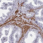 Atlas Antibodies Anti-NEURL4 Antibody