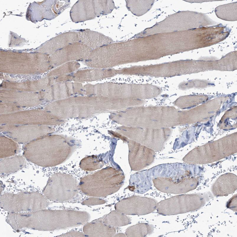 Atlas Antibodies Anti-NEU3 Antibody
