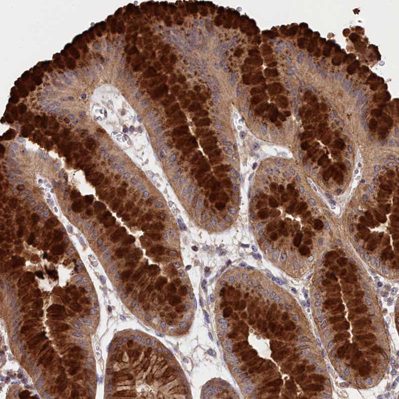 Atlas Antibodies Anti-NEURL4 Antibody