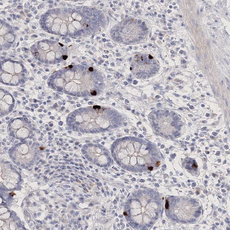 Atlas Antibodies Anti-NEU4 Antibody