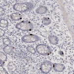 Atlas Antibodies Anti-NEU4 Antibody